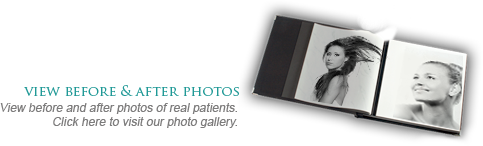 View Before & After Photos